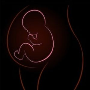 Meet your Posher, Azucena